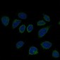Anti-Smad2 Rabbit Monoclonal Antibody